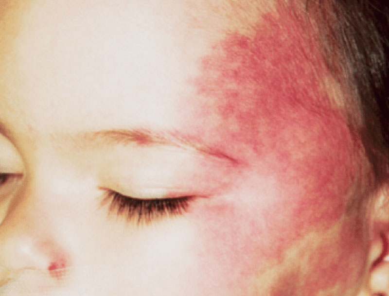 DERMACEN - DERMATOLOGIKO KENTRO A.E.: Φωτογραφίες & Βίντεο