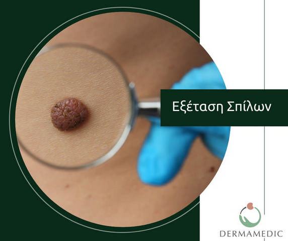 DERMAMEDIC - ΓΙΑΝΝΑΚΗ ΜΑΡΙΑ: Φωτογραφίες & Βίντεο
