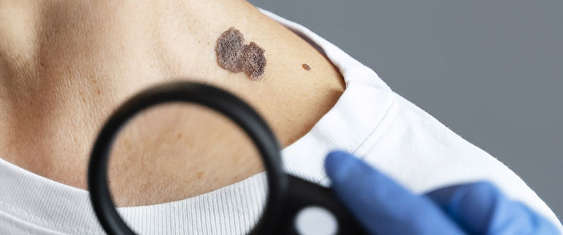 DERMATOLOGY - ΤΣΙΜΠΙΔΑΚΗΣ ΑΝΤΩΝΙΟΣ: Φωτογραφίες & Βίντεο