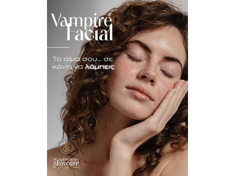 Vampire Facial