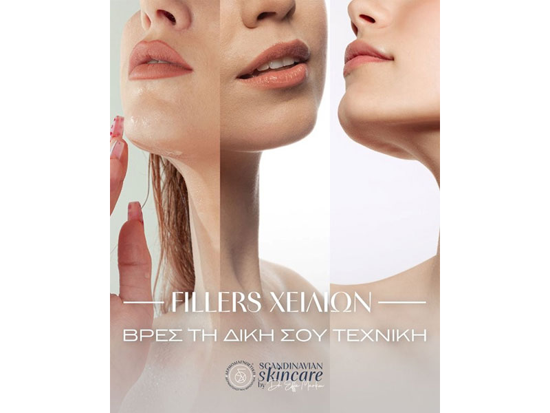Fillers Χειλιών