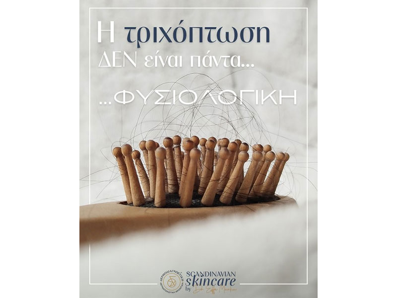 Τριχόπτωση