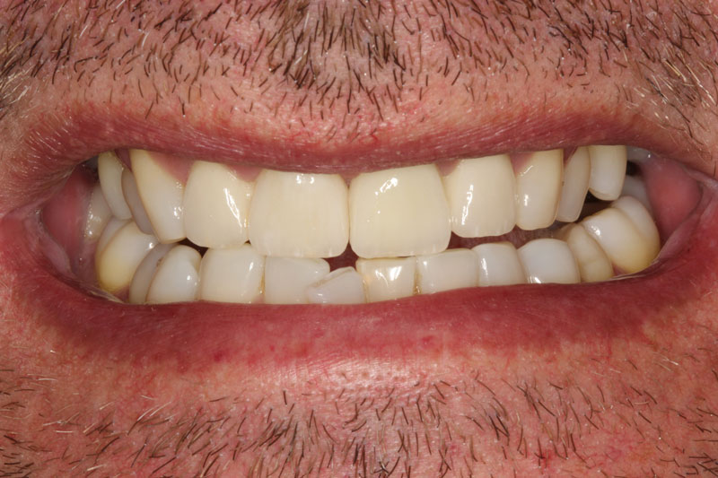 DKT DENTAL LAB - TARAKTSOGLOU AFOI: Φωτογραφίες & Βίντεο