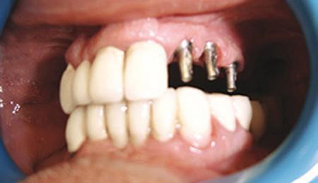ΔΡΟΣΟΣ Ε. ΖΑΧΑΡΙΑΣ Dr MED DENT: Φωτογραφίες & Βίντεο