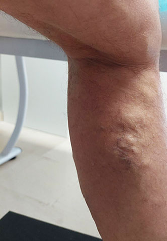 ELITE VASCULAR CENTRE - KOUTSOUMPELIS ANDREAS MB, MSc: Φωτογραφίες & Βίντεο