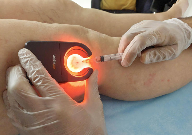 ELITE VASCULAR CENTRE - KOUTSOUMPELIS ANDREAS MB, MSc: Φωτογραφίες & Βίντεο