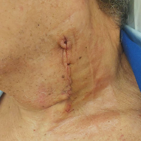 ELITE VASCULAR CENTRE - KOUTSOUMPELIS ANDREAS MB, MSc: Φωτογραφίες & Βίντεο