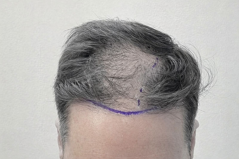 EPISTIMI HAIR CLINIC: Φωτογραφίες & Βίντεο