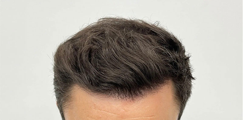 EPISTIMI HAIR CLINIC: Φωτογραφίες & Βίντεο