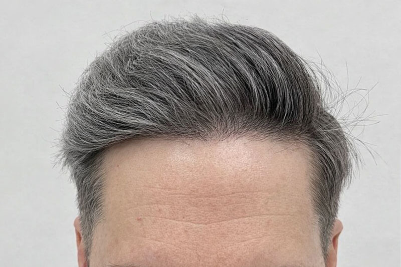 EPISTIMI HAIR CLINIC: Φωτογραφίες & Βίντεο