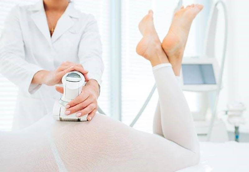 LPG Endermologie Method
