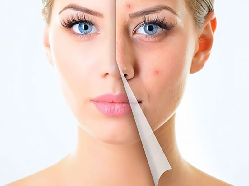 Enzymatic Facial Cleansing
