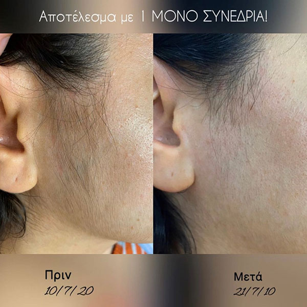 EU SKIN PETSINI - VOUTSINA: Φωτογραφίες & Βίντεο