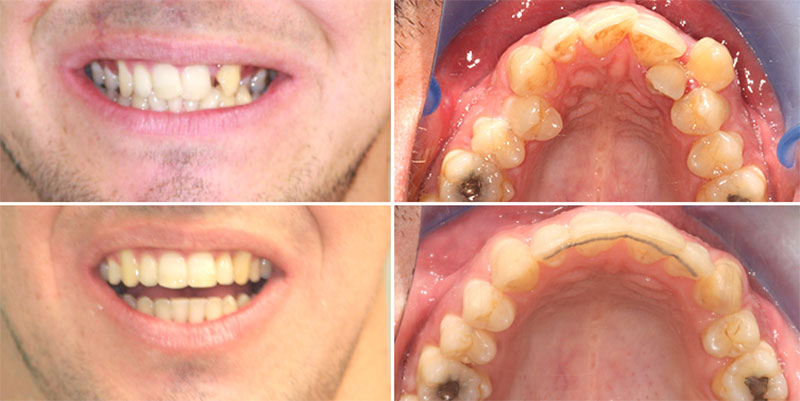 ΕΥΑΓΓΕΛΙΝΑΚΗΣ ΝΙΚΟΛΑΟΣ DDS, MSD - MY ORTHODONTISTS: Φωτογραφίες & Βίντεο