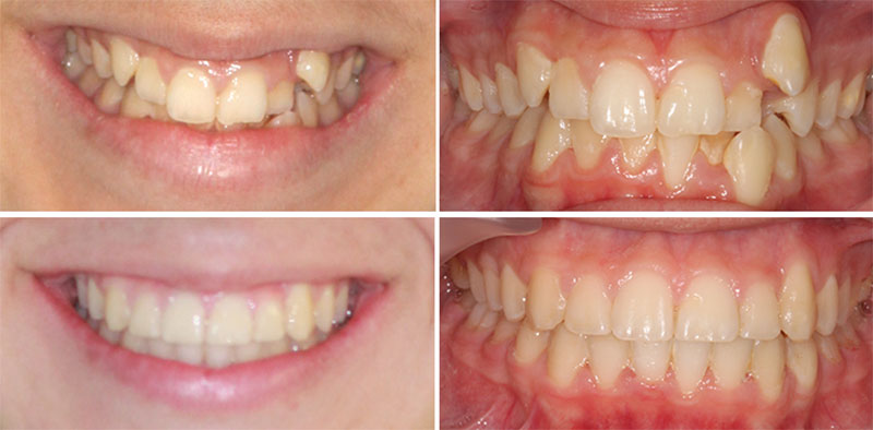 ΕΥΑΓΓΕΛΙΝΑΚΗΣ ΝΙΚΟΛΑΟΣ DDS, MSD - MY ORTHODONTISTS: Φωτογραφίες & Βίντεο