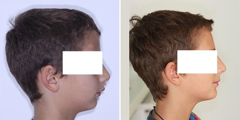 ΕΥΑΓΓΕΛΙΝΑΚΗΣ ΝΙΚΟΛΑΟΣ DDS, MSD - MY ORTHODONTISTS: Φωτογραφίες & Βίντεο