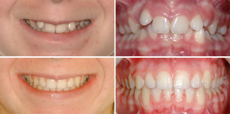 ΕΥΑΓΓΕΛΙΝΑΚΗΣ ΝΙΚΟΛΑΟΣ DDS, MSD - MY ORTHODONTISTS: Φωτογραφίες & Βίντεο