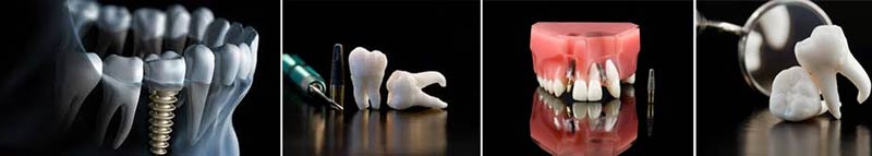 Oral surgery