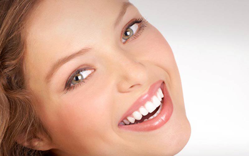 Teeth whitening
