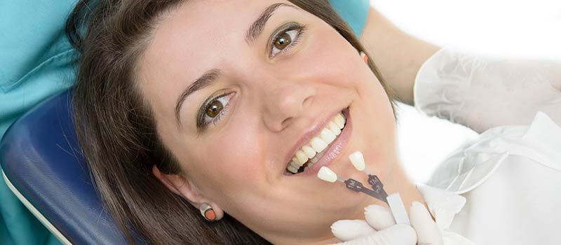 Porcelain veneers