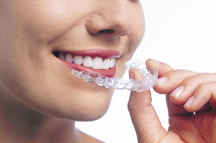Invisalign