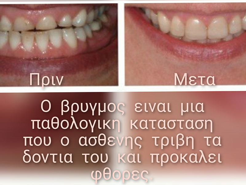 GKIRMPA PEPI: Φωτογραφίες & Βίντεο