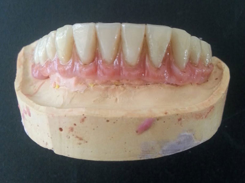 GKdental Lab - Κωνσταντόπουλος Γιώργος BSc