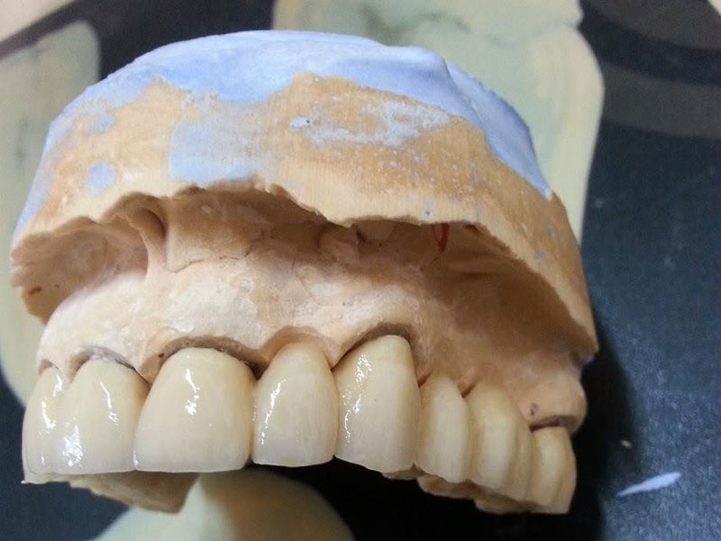 GKdental Lab - Κωνσταντόπουλος Γιώργος BSc