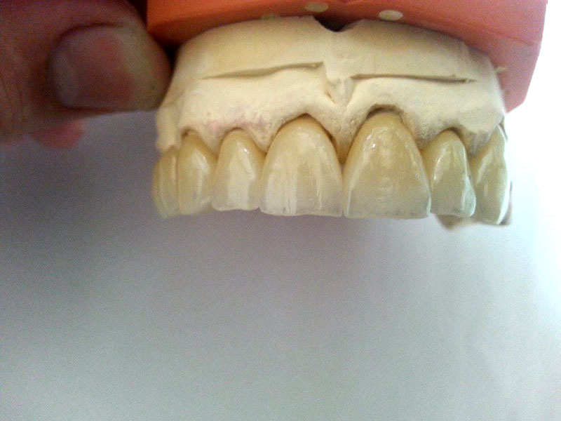 GKdental Lab - Κωνσταντόπουλος Γιώργος BSc