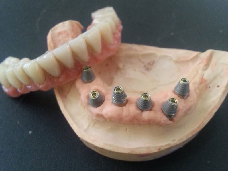 GKdental Lab - Κωνσταντόπουλος Γιώργος BSc