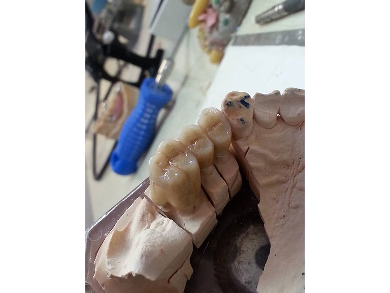 GKdental Lab - Κωνσταντόπουλος Γιώργος BSc