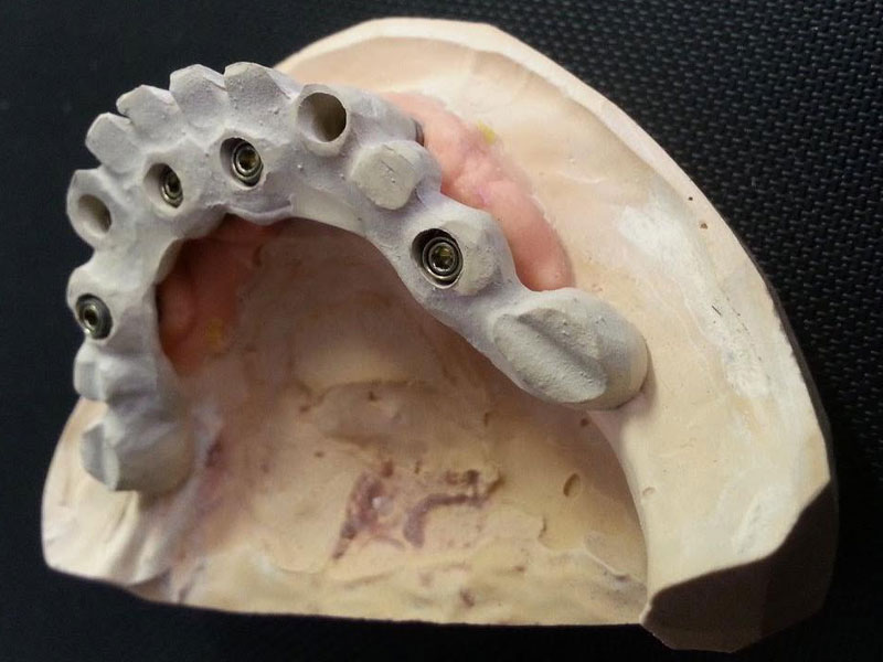 GKdental Lab - Κωνσταντόπουλος Γιώργος BSc