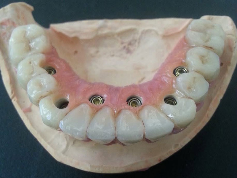 GKdental Lab - Κωνσταντόπουλος Γιώργος BSc