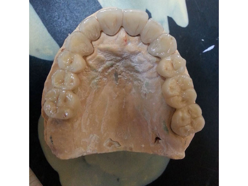 GKdental Lab - Κωνσταντόπουλος Γιώργος BSc