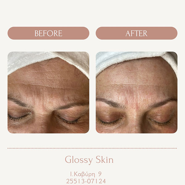 GLOSSY SKIN - ΜΠΑΚΑΛΑΚΗ ΛΙΑΝΑ: Φωτογραφίες & Βίντεο