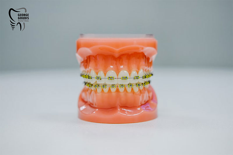 GOUDIS DENTAL CLINIC - GOUDIS GEORGIOS DDS: Φωτογραφίες & Βίντεο