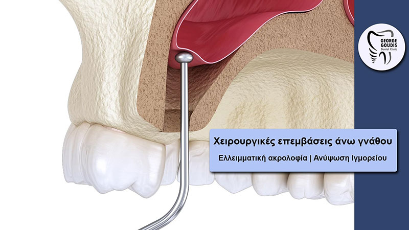 GOUDIS DENTAL CLINIC - GOUDIS GEORGIOS DDS: Φωτογραφίες & Βίντεο