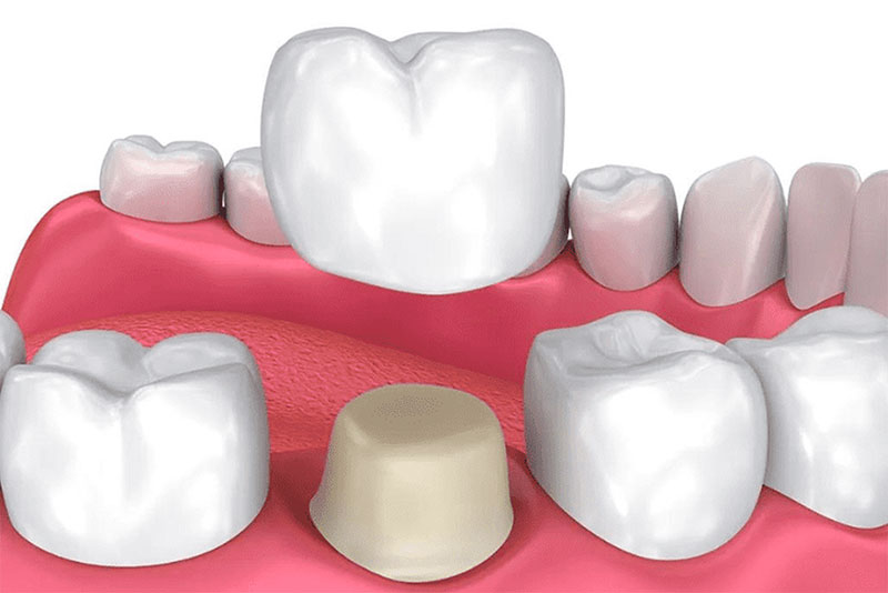 GOUDIS DENTAL CLINIC - GOUDIS GEORGIOS DDS: Φωτογραφίες & Βίντεο