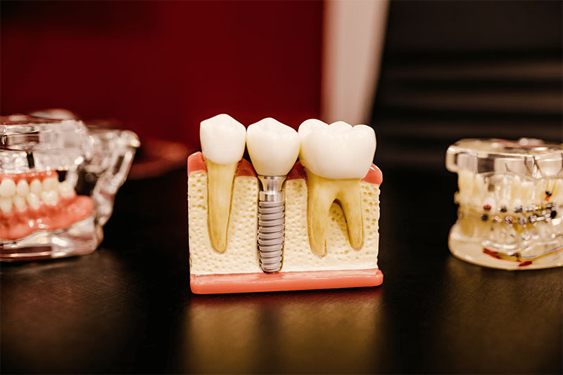 GOUDIS DENTAL CLINIC - GOUDIS GEORGIOS DDS: Φωτογραφίες & Βίντεο