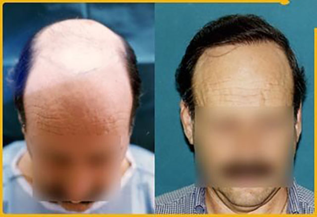 GOURAS IOANNIS Dr - GOURAS HAIR GENESIS CLINIC: Φωτογραφίες & Βίντεο