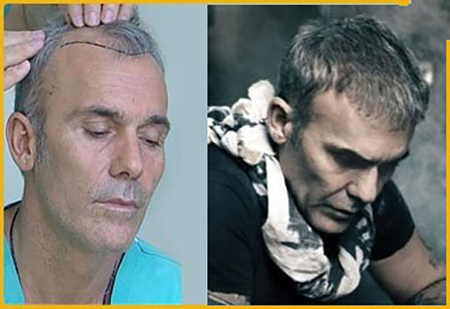 GOURAS IOANNIS Dr - GOURAS HAIR GENESIS CLINIC: Φωτογραφίες & Βίντεο