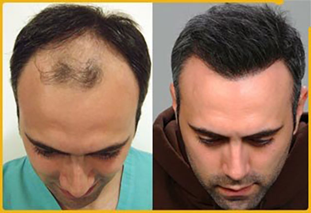GOURAS IOANNIS Dr - GOURAS HAIR GENESIS CLINIC: Φωτογραφίες & Βίντεο