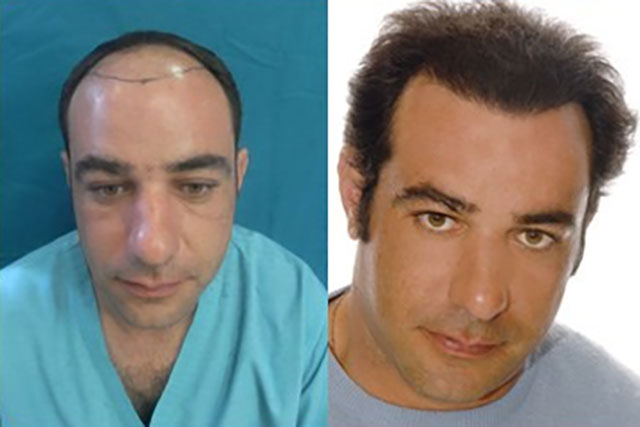 GOURAS IOANNIS Dr - GOURAS HAIR GENESIS CLINIC: Φωτογραφίες & Βίντεο