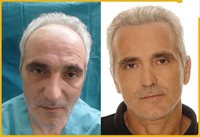 GOURAS IOANNIS Dr - GOURAS HAIR GENESIS CLINIC: Φωτογραφίες & Βίντεο