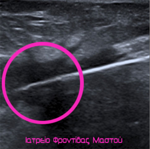 Ultrasounds