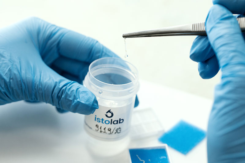 ISTOLAB - GKOURVAS VIKTORAS & SEKOULI ARGYRO: Φωτογραφίες & Βίντεο