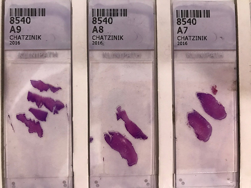 Τα πλακίδια φέρουν μοναδικό barcode με το επίθετο & αριθμό πρωτοκόλλου, για την καλύτερη δυνατή ταυτοποίηση δείγματος