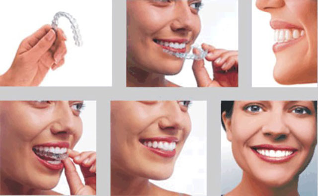 JUST SMILE - ΑΡΑΒΑΝΤΙΝΟΣ ΕΥΑΓΓΕΛΟΣ: Φωτογραφίες & Βίντεο
