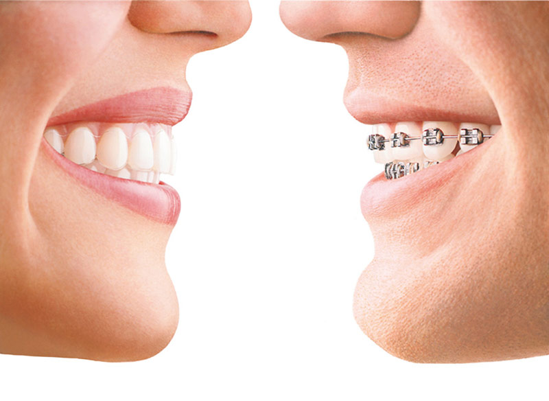 JUST SMILE - ΑΡΑΒΑΝΤΙΝΟΣ ΕΥΑΓΓΕΛΟΣ: Φωτογραφίες & Βίντεο