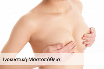 ΚΑΡΑΓΙΑΝΝΙΔΗΣ ΑΡΗΣ: Φωτογραφίες & Βίντεο